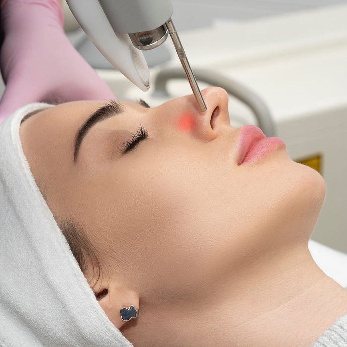 6D%20Laser%20Peel%20Hot.jpg