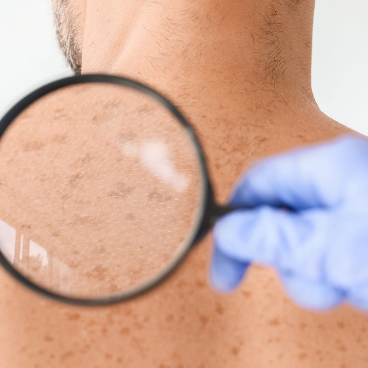 Anti-pigmentation.jpg